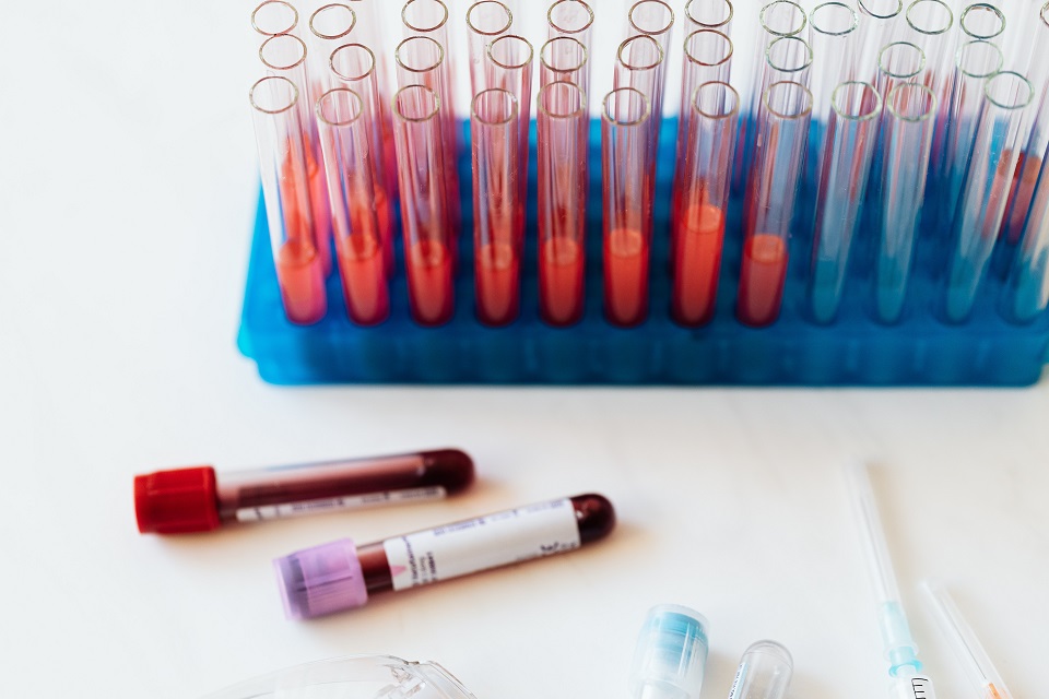 Las transfusiones de sangre y sus derivados ayudan a salvar millones de pacientes con enfermedades potencialmente mortales.