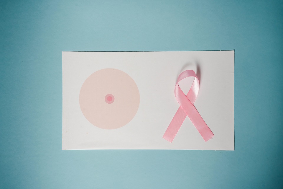 Los síntomas del cáncer de mama no suelen aparecer de manera temprana, por lo que los controles preventivos son fundamentales.